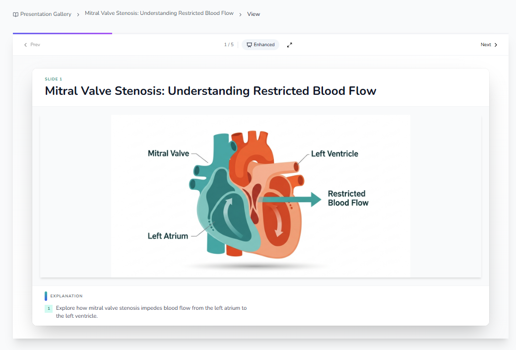 Mitral Valve Stenosis slide with heart diagram and explanation